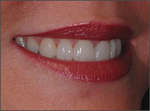 After-Ortho-Venners-Atlanta-GA