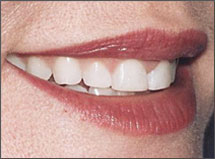 Before-Ortho-Atlanta-GA