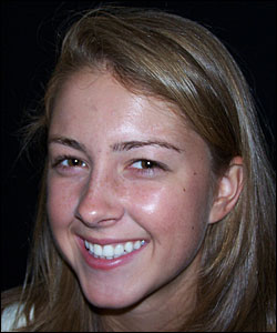 After-Braces-Implants-Crowns-Atlanta-GA