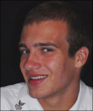 After-Veneers-Atlanta-GA